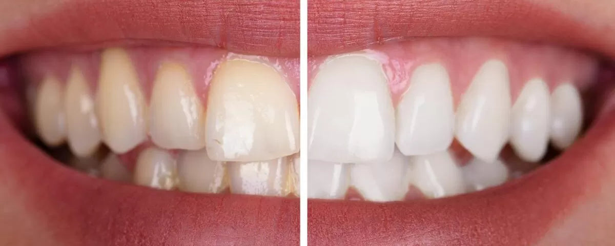 Mosoly360 AutoBrush™