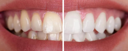 Mosoly360 AutoBrush™